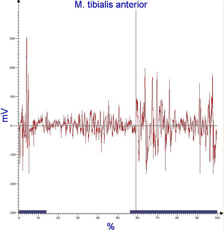 Abbildung Rohsignal der Muskelaktivität am Beispiel Tibialis Anterior